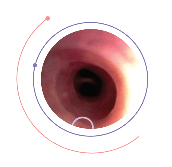 Always-on Visualization
