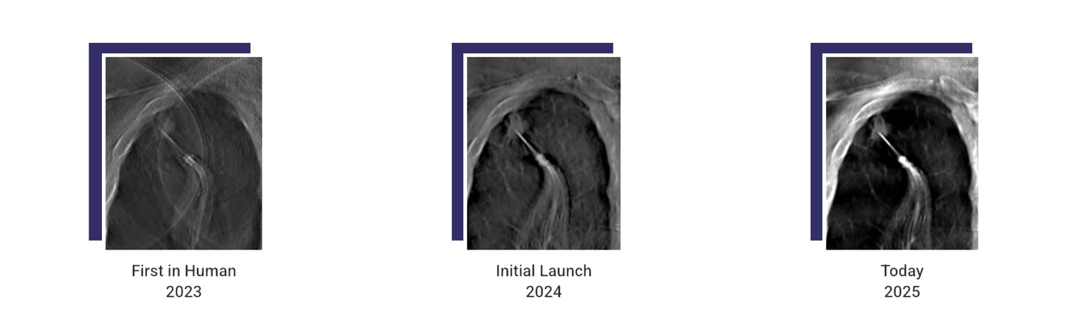 Digital Tomo Progression