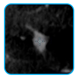 Dual Mode Imaging Dual Mode Imaging