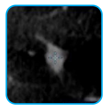 Dual Mode Imaging