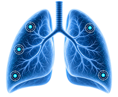 Generic Lung Image Generic Lung Image
