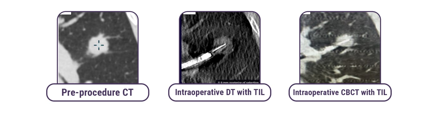 MATCH 2 Case Images MATCH 2 Case Images