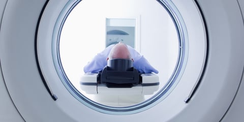 Roadblocks to Lung Cancer Screening: Why Early Detection Is Still Falling Short