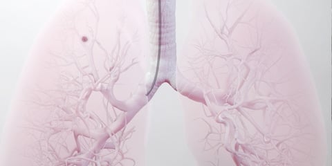 2025 Predictions in Medical Robotics: Integrated Procedures for Diagnosis, Biopsy and Treatment