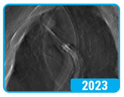 HD-DT 2023-1 HD-DT 2023-1