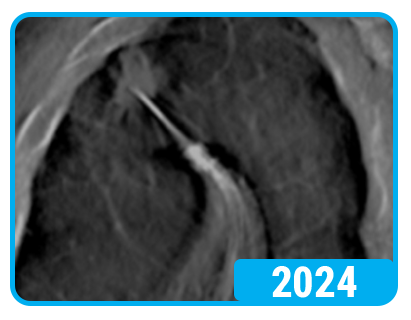 HD-DT 2024-1 HD-DT 2024-1