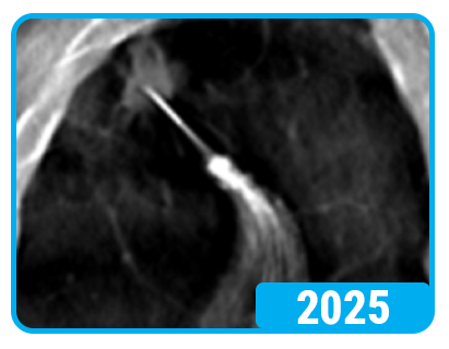 HD-DT 2025-1 HD-DT 2025-1