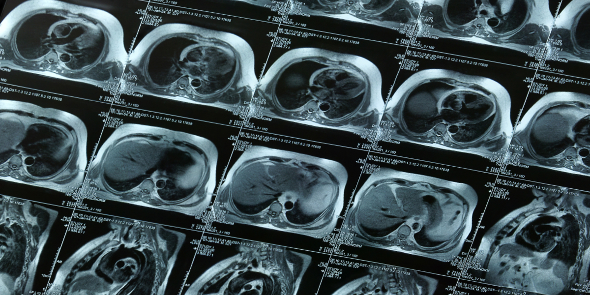 Why Advances in Imaging Will Revolutionize the Way We Detect and Treat Disease